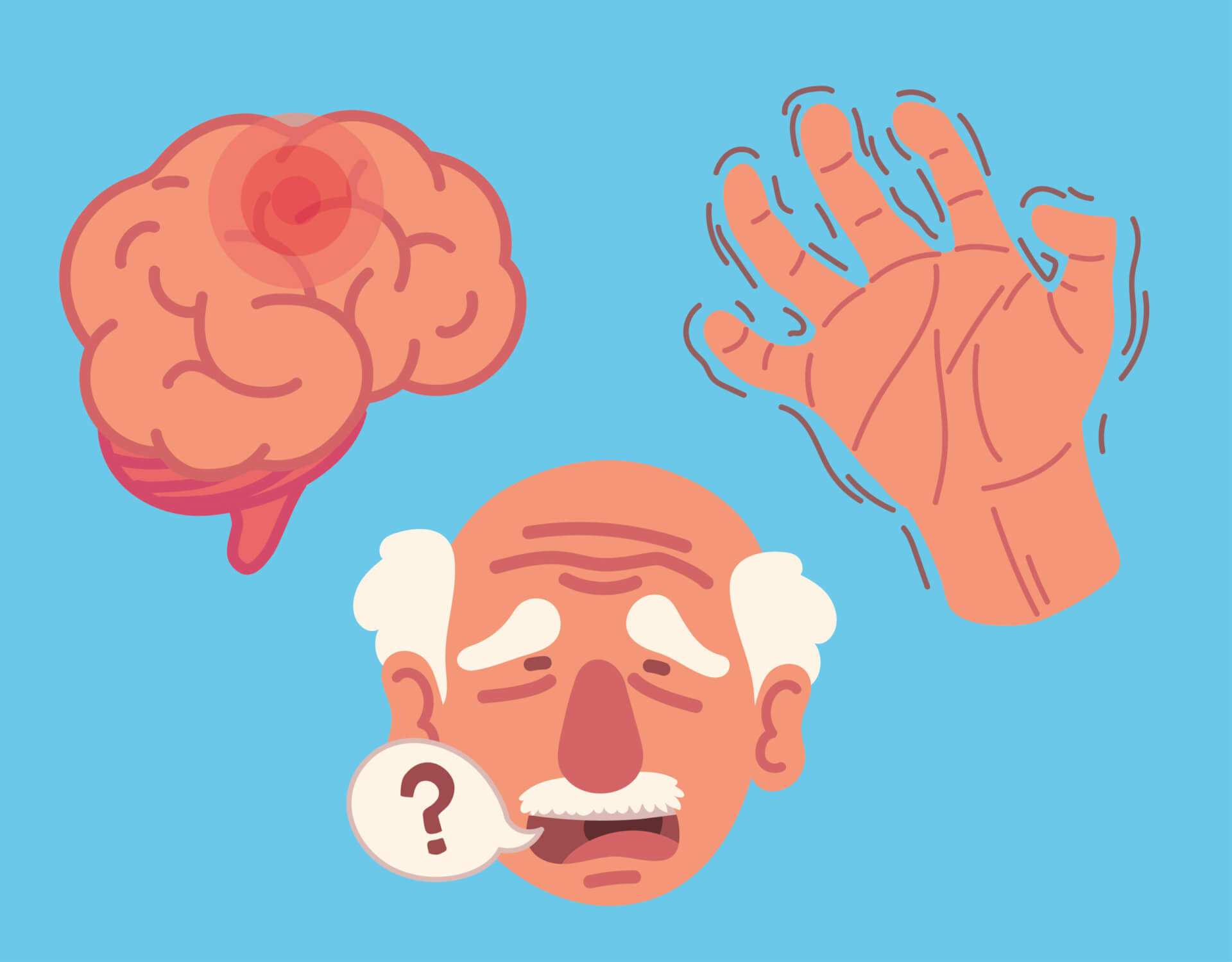 Mann zeigt zittern als Zeichen für eine mögliche Parkinson Erkrankung